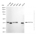 KD-Validated PCYT1A Rabbit mAb (20 μl)