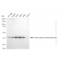 KD-Validated PRMT1 Rabbit mAb (20 μl)