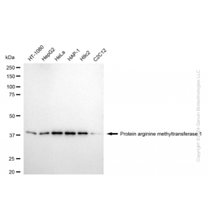KD-Validated PRMT1 Rabbit mAb (20 μl)