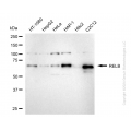 KD-Validated RELB Rabbit mAb (20 μl)
