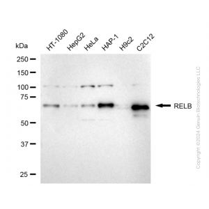 KD-Validated RELB Rabbit mAb (20 μl)