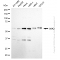 KD-Validated RPS6KB2 Rabbit mAb (20 μl)