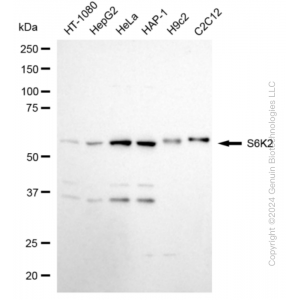 KD-Validated RPS6KB2 Rabbit mAb (20 μl)