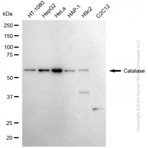 KD-Validated CAT Rabbit mAb (20 μl)