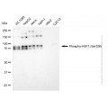 KD-Validated Phospho-HSF1 (Ser326) Rabbit mAb (20 μl)