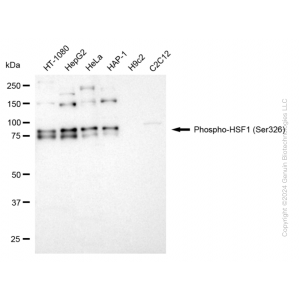 KD-Validated Phospho-HSF1 (Ser326) Rabbit mAb (20 μl)