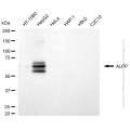 KD-Validated ALPP Rabbit mAb (20 μl)