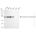KD-Validated Phospho-HSF1 (Ser303/Ser307) Rabbit mAb (20 μl)