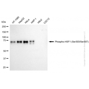 KD-Validated Phospho-HSF1 (Ser303/Ser307) Rabbit mAb (20 μl)