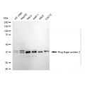 KD-Validated RNF2 Rabbit mAb (20 μl)
