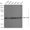KD-Validated AP3M1 Rabbit mAb (20 μl)