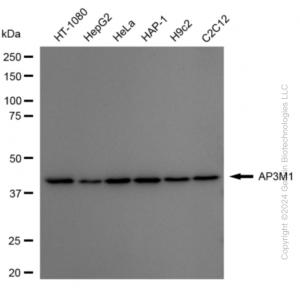 KD-Validated AP3M1 Rabbit mAb (20 μl)