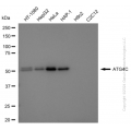 KD-Validated ATG4C Rabbit mAb (20 μl)