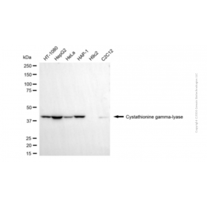 KD-Validated CTH Mouse mAb (20 μl)