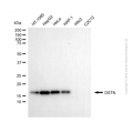 KD-Validated DSTN Mouse mAb (20 μl)