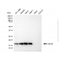 KD-Validated DSTN Mouse mAb (20 μl)