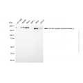 KD-Validated ERBB2 Mouse mAb (20 μl)