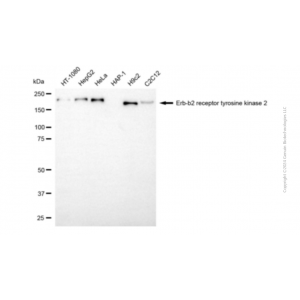 KD-Validated ERBB2 Mouse mAb (20 μl)