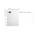 KD-Validated EGFR Mouse mAb (20 μl)