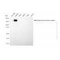 KD-Validated EGFR Mouse mAb (20 μl)