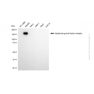 KD-Validated EGFR Mouse mAb (20 μl)