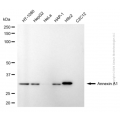 KD-Validated ANXA1 Mouse mAb (20 μl)