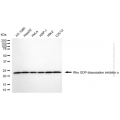 KD-Validated ARHGDIA Mouse mAb (20 μl)