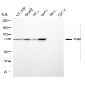 KD-Validated PFKP Mouse mAb (20 μl)