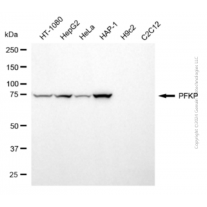 KD-Validated PFKP Mouse mAb (20 μl)