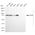 KD-Validated PFKP Mouse mAb (20 μl)