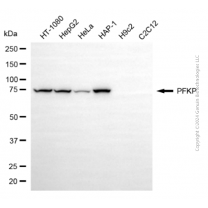 KD-Validated PFKP Mouse mAb (20 μl)