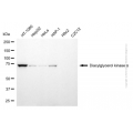 KD-Validated DGKA Mouse mAb (20 μl)
