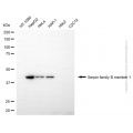 KD-Validated SERPINB1 Mouse mAb (20 μl)