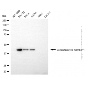 KD-Validated SERPINB1 Mouse mAb (20 μl)