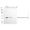 KD-Validated SERPINB1 Mouse mAb (20 μl)