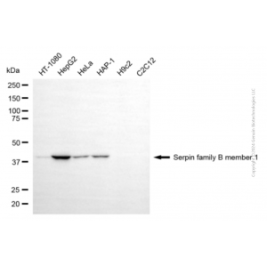 KD-Validated SERPINB1 Mouse mAb (20 μl)