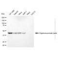 KD-Validated ASL Mouse mAb (20 μl)