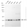 KD-Validated GIPC1 Mouse mAb (20 μl)