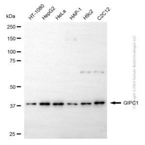 KD-Validated GIPC1 Mouse mAb (20 μl)
