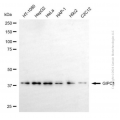 KD-Validated GIPC1 Mouse mAb (20 μl)