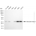 KD-Validated AK3 Mouse mAb (20 μl)