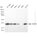 KD-Validated GRHPR Mouse mAb (20 μl)