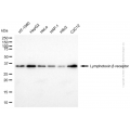 KD-Validated LTBR Mouse mAb (20 μl)