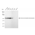 KD-Validated G6PD Rabbit mAb (20 μl)