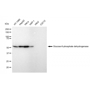KD-Validated G6PD Rabbit mAb (20 μl)