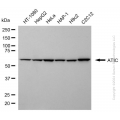 KD-Validated ATIC Mouse mAb (20 μl)