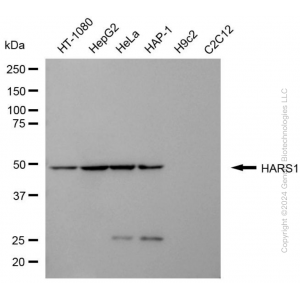 KD-Validated HARS1 Mouse mAb (20 μl)