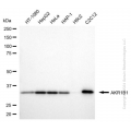 KD-Validated AKR1B1 Mouse mAb (20 μl)