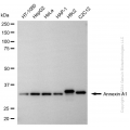 KD-Validated ANXA1 Rabbit mAb (20 μl)