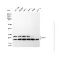 KD-Validated BTF3 Rabbit mAb (20 μl)